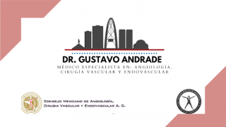 varicose veins specialists tijuana Dr Gus Medico Angiólogo Especialista en pie diabético, Cirugía vascular, Endovascular, Enfermedades de Circulación y Varices Tijuana