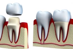 specialists cutaneous abscess tijuana My Baja Dental