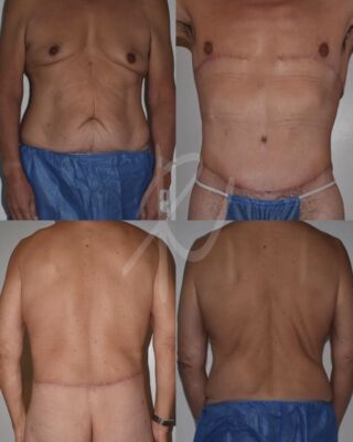 otoplasty clinics tijuana Ricardo Vega